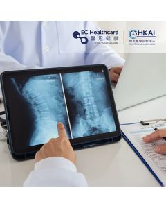 脊柱健康 - EOS 全身立體模擬造影FULL BODY AP & LAT (3D Spine Model)